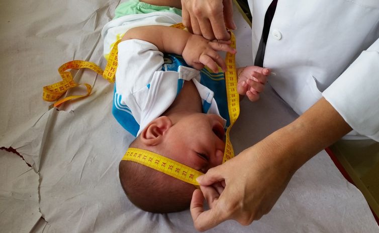 Bebê com microcefalia - Sumaia Villela/Agência Brasil