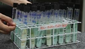 Teste para confirmação de tuberculose utilizando cultura da bactéria em ovos. Maicon Lemes Costa/ Secom/RO